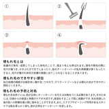 iroha VIO TREATMENT LOTION